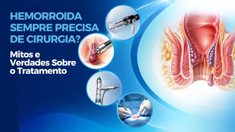 Hemorroida Sempre Precisa de Cirurgia? Mitos e Verdades Sobre o Tratamento
